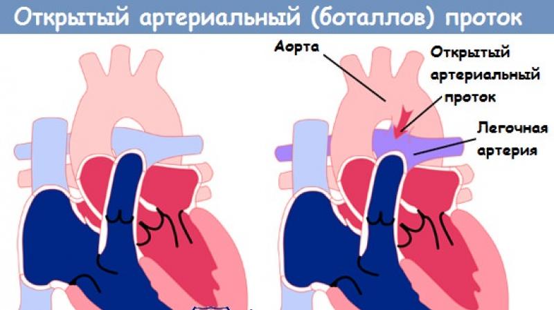 Венозный проток Кровоток в венозном протоке однонаправленный