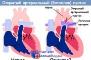 Ductus venosus Protok krvi u ductus venosus je jednosmjeran